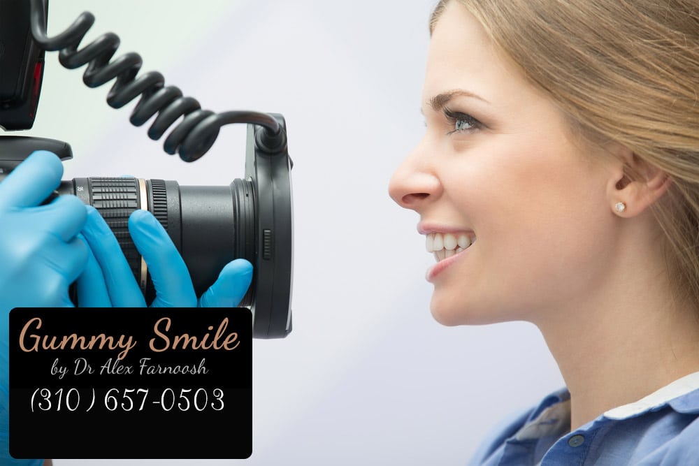 Researching Dark Gums Treatment in Los Angeles
