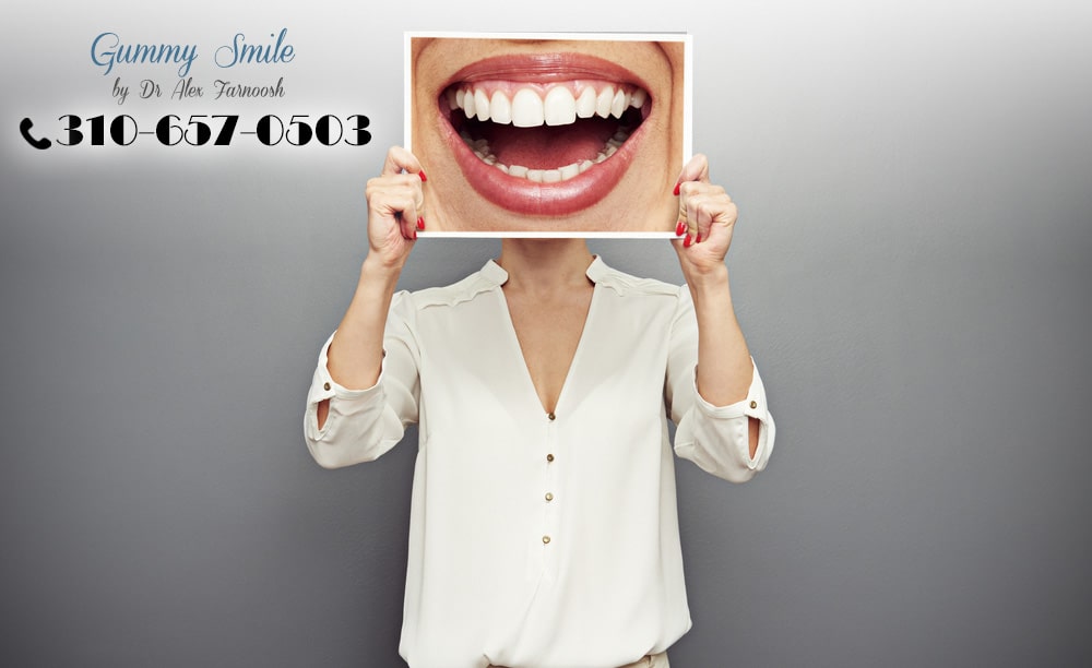 The Steps to Fixing a Gummy Smile