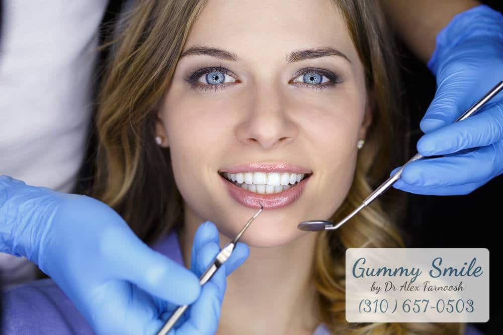 The Process of Gum Whitening in Los Angeles Gummy Smile