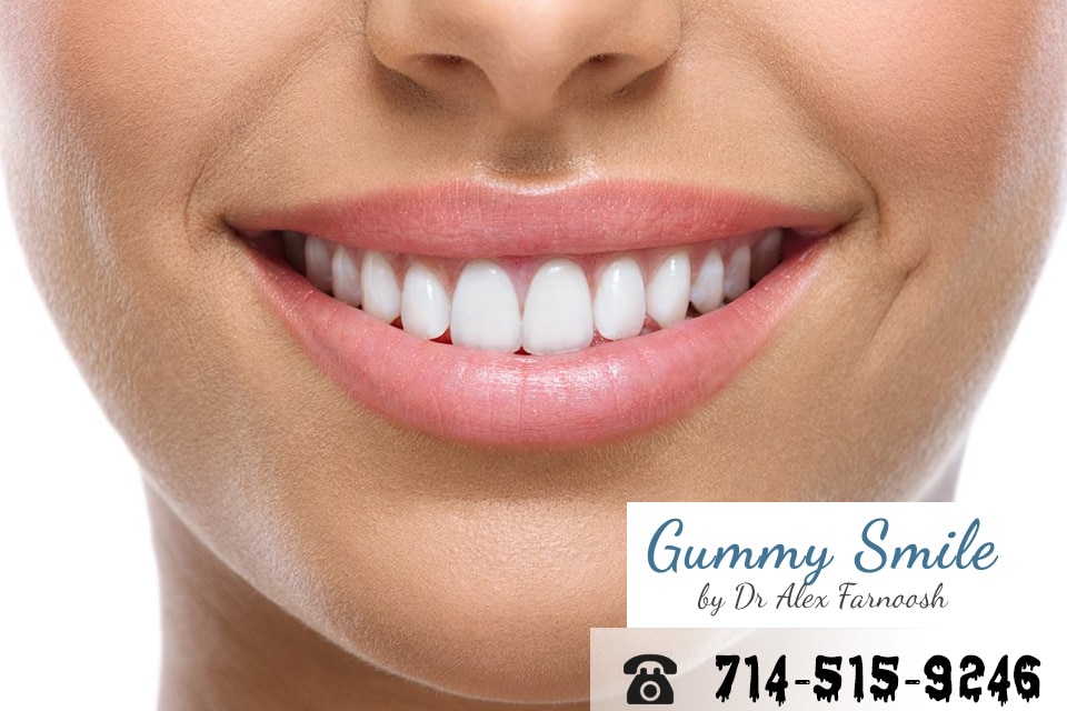 Overcome Your DiscoloredGums with Our Los AngelesClinic