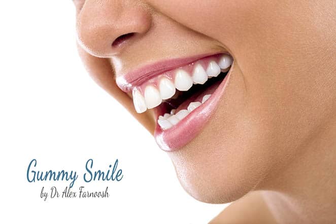 Seeking a Beverly Hills Cosmetic Dentist